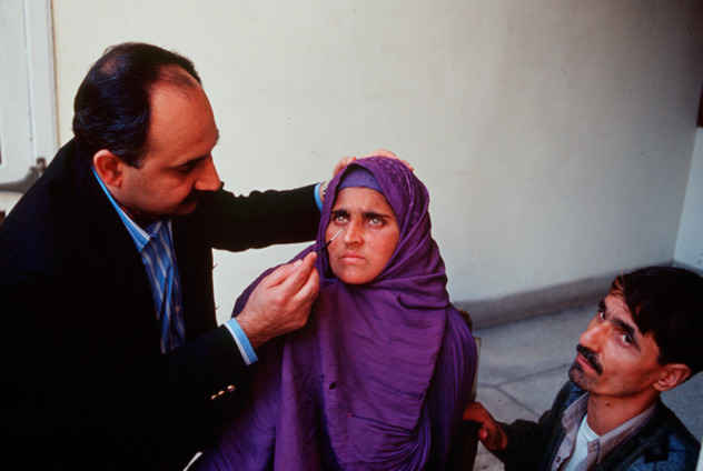 Afghan Girl eyes examined